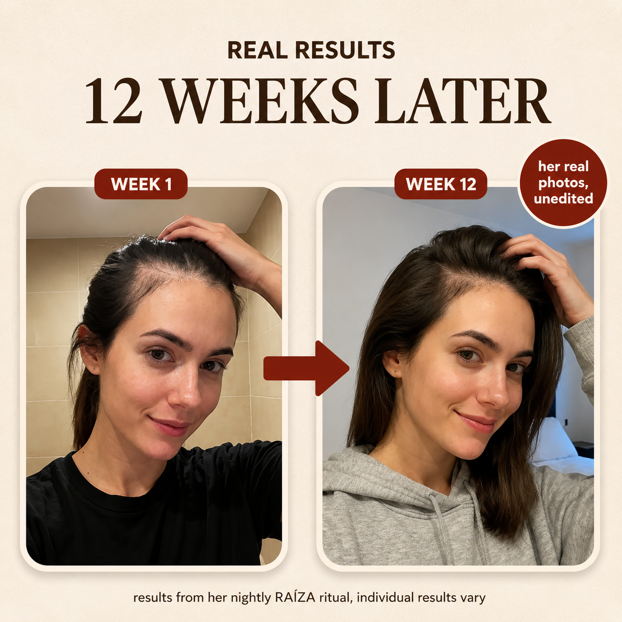 RAÍZA Batana Oil Hair Growth Serum